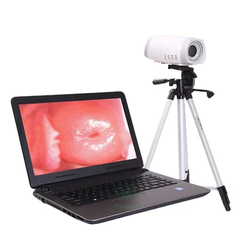 MI-F003 medicale ginecologie portabil mini digital video colposcop pentru vagin